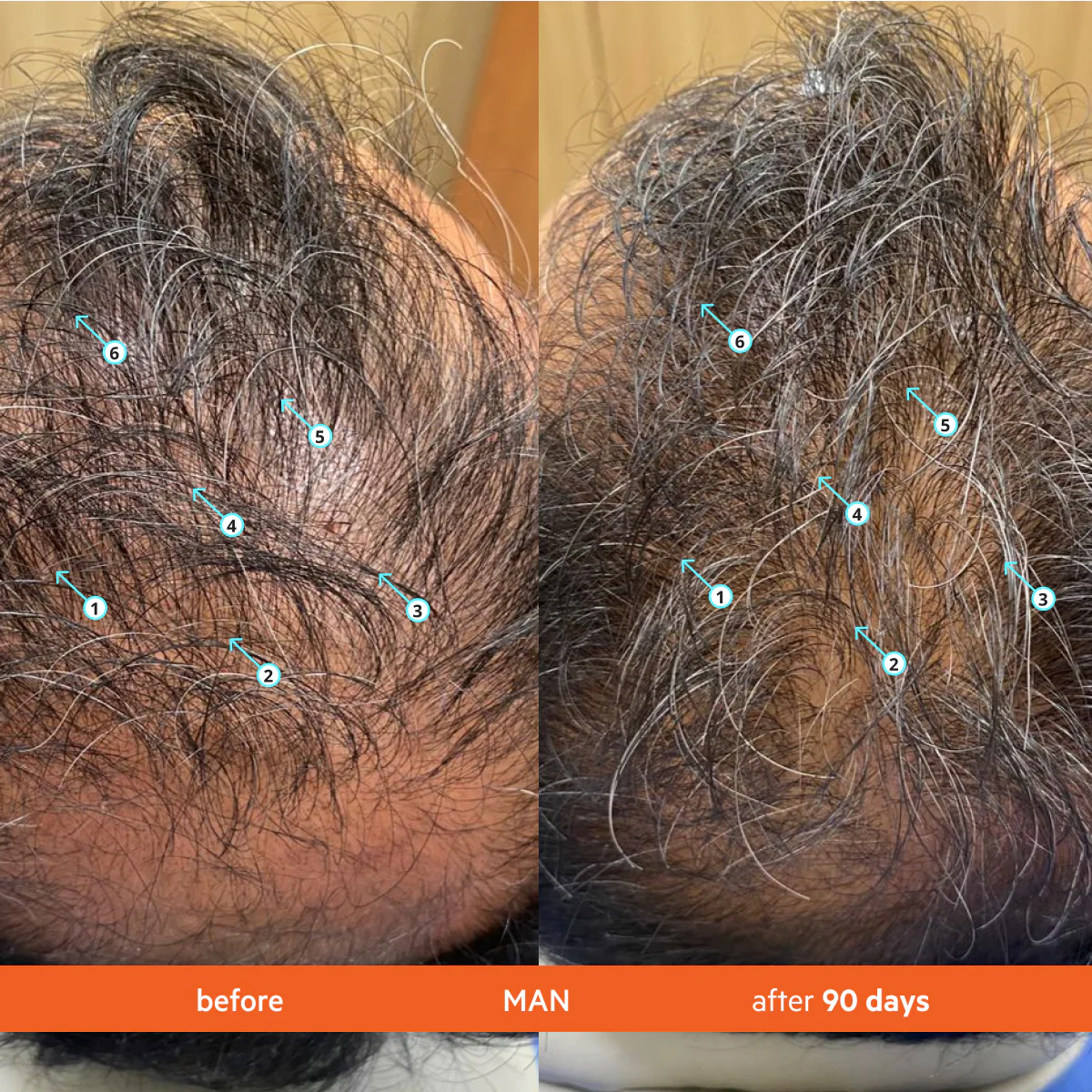 MentaPure™ High-Performance Hair Density Shampoo