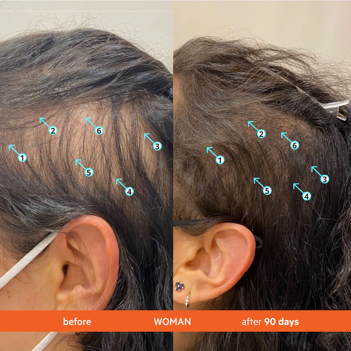 MentaPure™ High-Performance Hair Density Shampoo