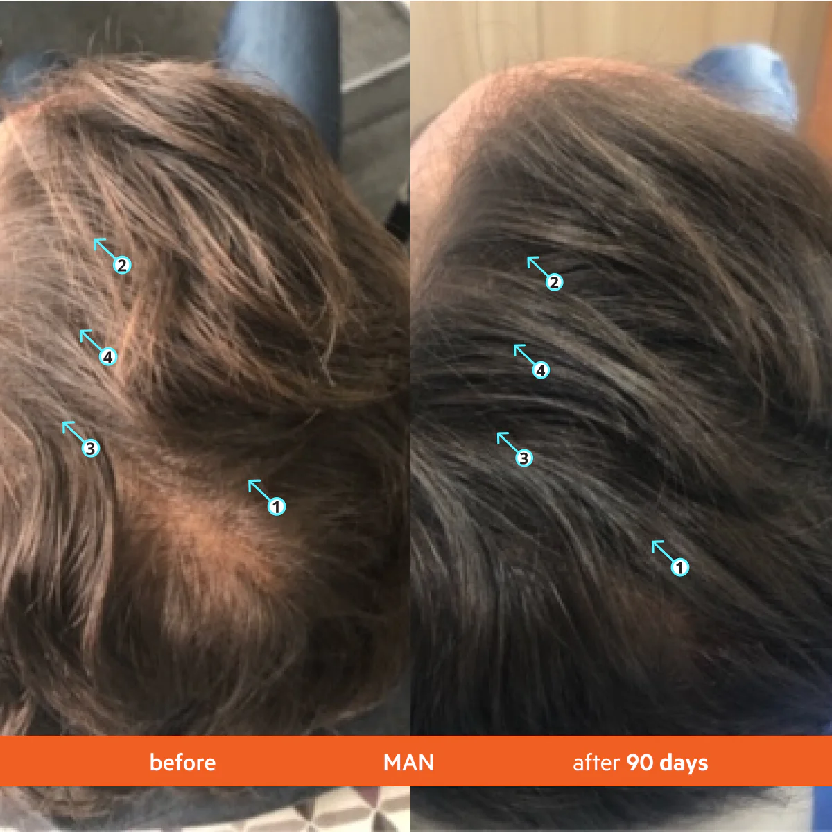 MentaPure™ High-Performance Hair Density Shampoo
